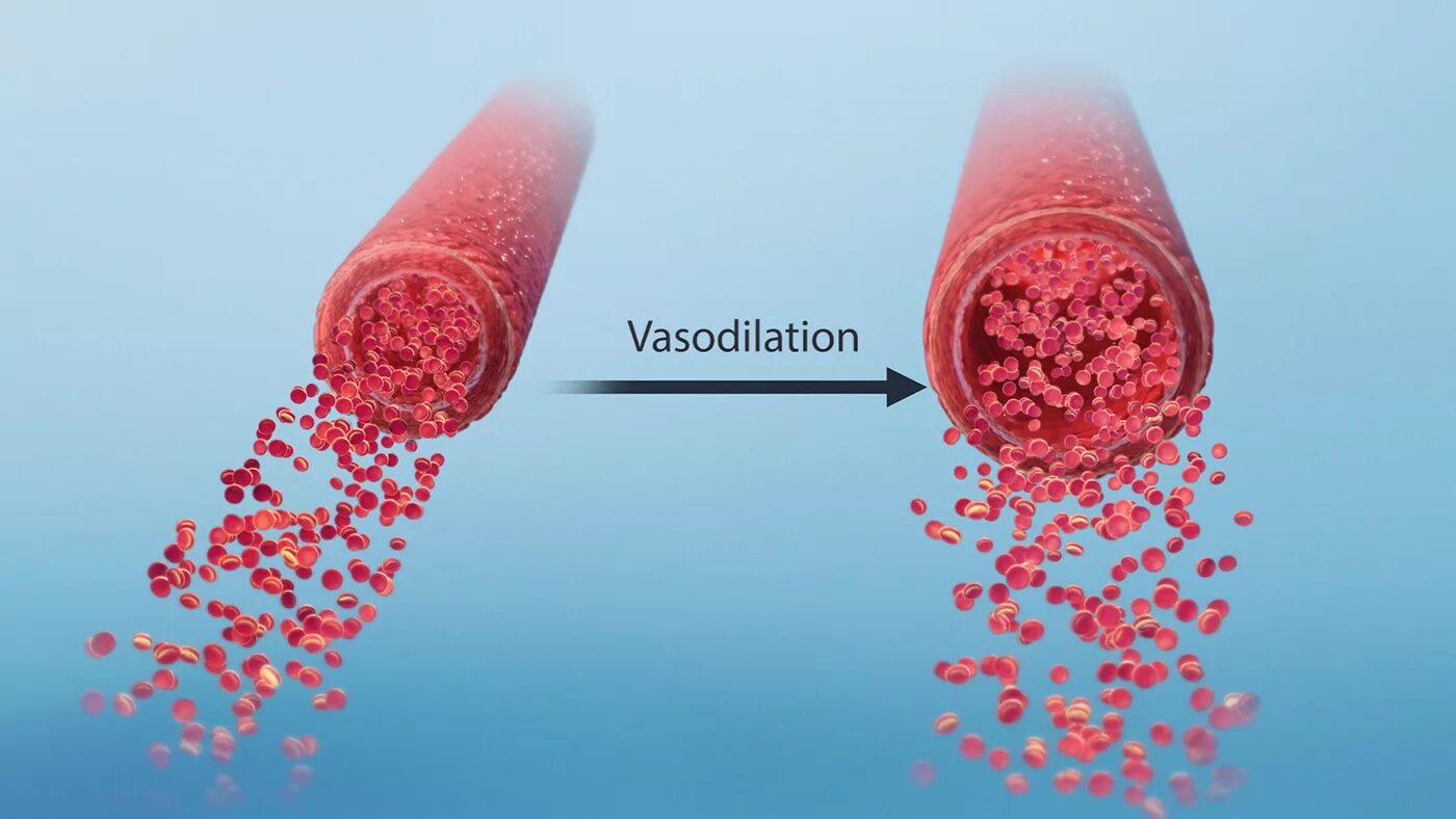 Расширение стенок сосудов. Расширение кровеносных сосудов. Сужение и расширение сосудов. Расширение периферических сосудов.