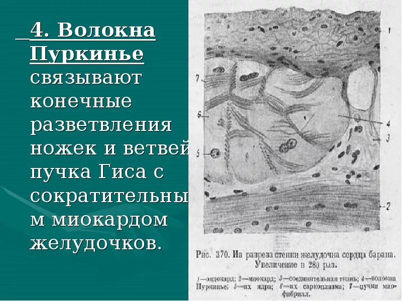 Сердце волокна пуркинье гистология препарат. Эндокард и миокард гистология препарат. Волокна пуркинье препарат гистология. Волокна пуркинье в сердце. Стенка сердца волокна пуркинье гистологический препарат.