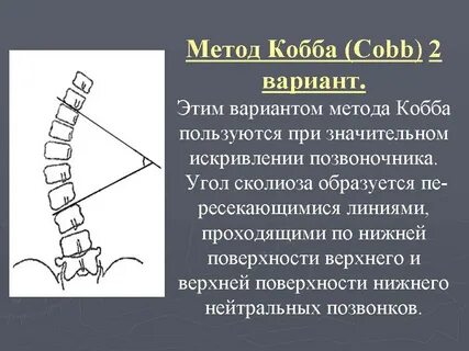 Угол кривизны