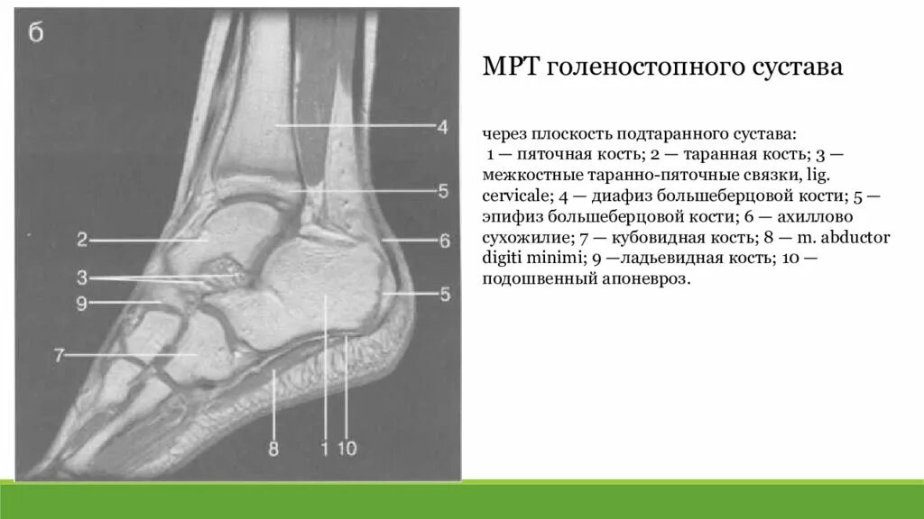 Диагноз голеностопный сустав. Анатомия голеностопного сустава мрт. Мрт анатомия голеностопного сустава Аксиал. Голеностоп рентген анатомия. Таранная кость подтаранный сустав.