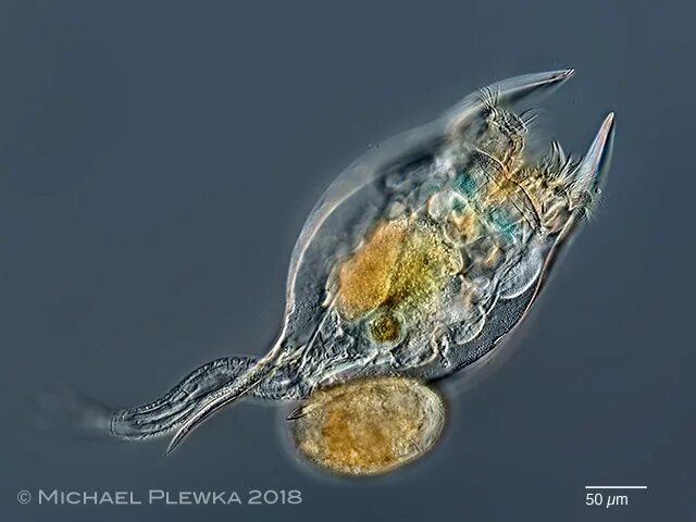 Brachionus diversicornis. Яйцо коловратки. Коловратка брахионус строение. Коловратка строение. Коловратки в экосистеме