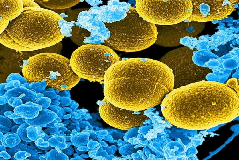 Стрептококк ауреус. Staphylococcus aureus царство. Золотистый стафилококк септицемия.