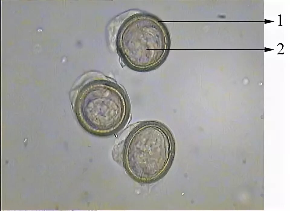 Онкосфера карликовый цепень. Яйцо (онкосфера) тениид. Яйца онкосферы тениид. Онкосфера свиного цепня. Яйцо с онкосферой