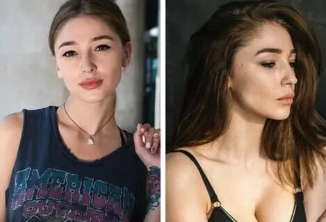 Ивлеева пластика