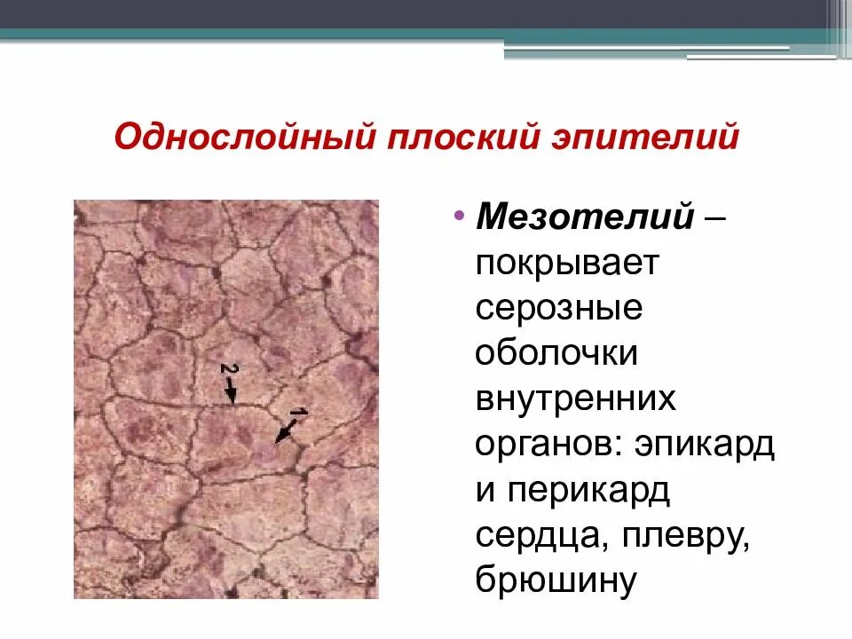 Мезотелий развивается из. Однослойный плоский эпителий мезотелий брюшины препарат. Мезотелий брюшины гистология. Однослойный плоский эпителий серозной оболочки мезотелий. Мезотелий гистология препарат.