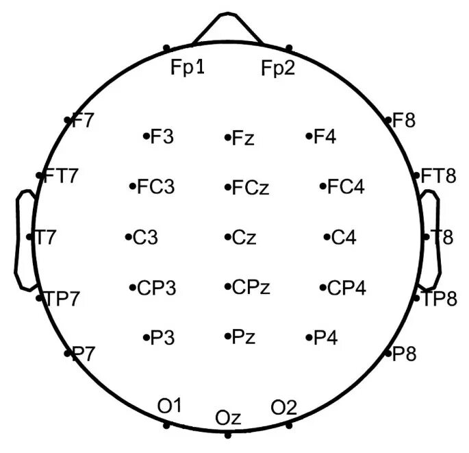 Схема ЭЭГ 10-20. Система 10-20 установка электродов. ЭЭГ наложение электродов схема 10-20. 10-20 EEG.