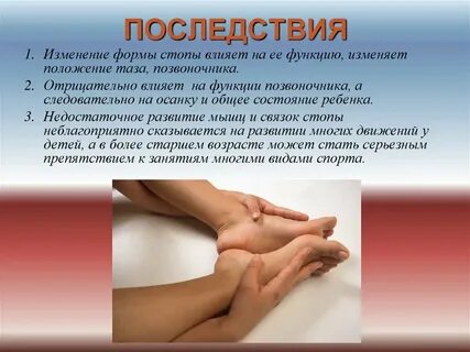 Стопа осанка