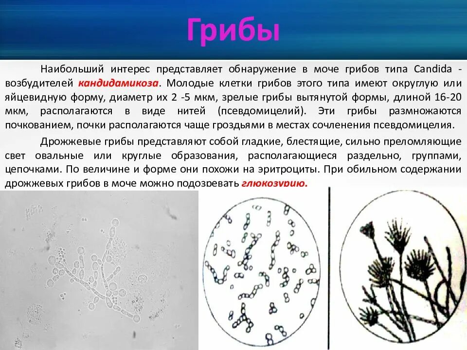 Почему в моче осадки
