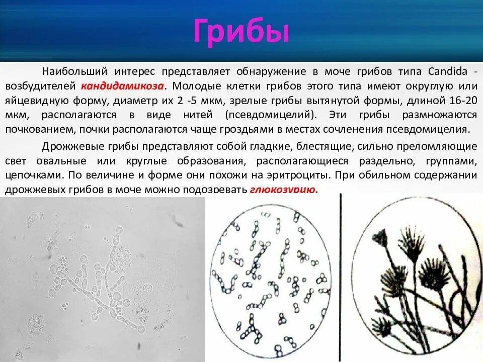 Дрожжевые клетки в моче повышены. Мицелий гриба микроскопия. Грибы кандида микроскопия. Дрожжевые клетки гриба рода кандида. Микроскопические грибы Candida.