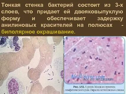 Чума холера сибирская язва