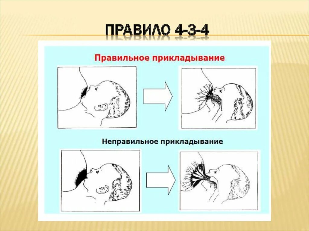 Неправильный захват. Как правильно прикладывать к груди. Как прикладывать ребенка к груди. Правильное прикладывание к груди. Неправильное прикладывание ребенка к груди.