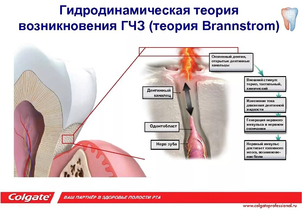 Почему чувствительность зуба. Гидродинамическая теория боли. Гидродинамическая теория повышенной чувствительности зубов. Гидродинамическая теория гиперестезии. Гидродинамическая теория чувствительности дентина.
