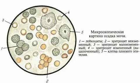 Лейкоциты в моче после антибиотиков