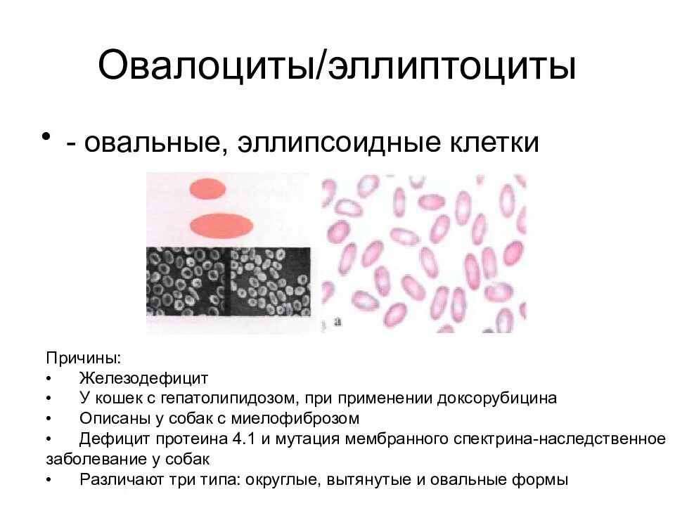 Патологические формы эритроцитов