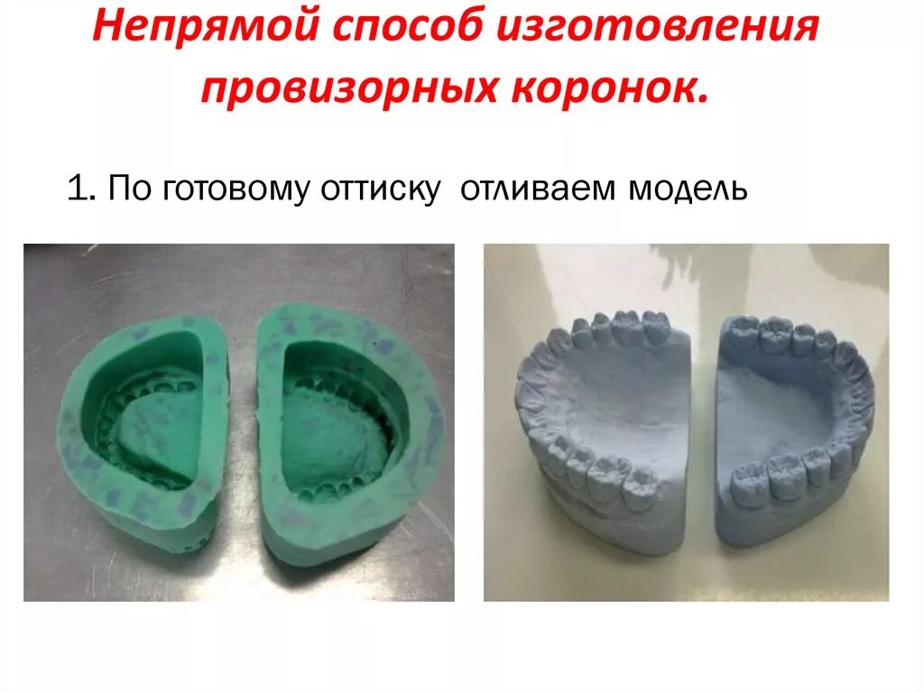 Прямой метод изготовления провизорных коронок. Провизорные коронки материал. Прямой и непрямой методы изготовления коронок. Материал для изготовления провизорных коронок. Методы изготовления протезов