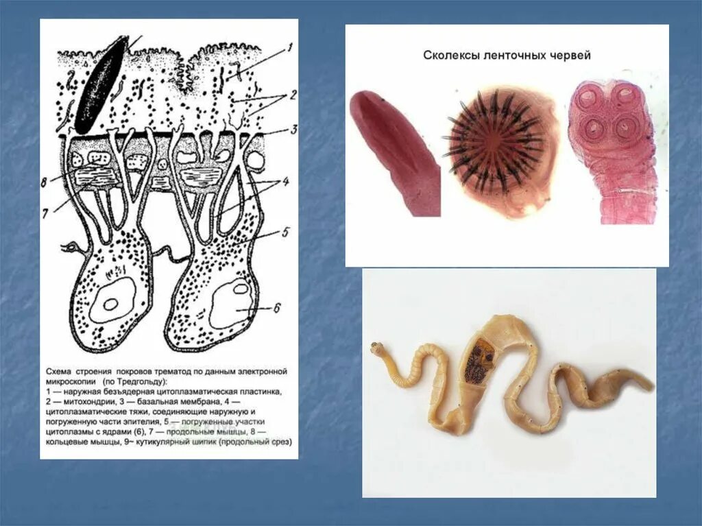 Ленточные и плоские черви. Медицинская гельминтология ленточные черви. Медицинская гельминтология Тип плоские черви. Плоские черви ленточные строение. Сколексы ленточных червей.