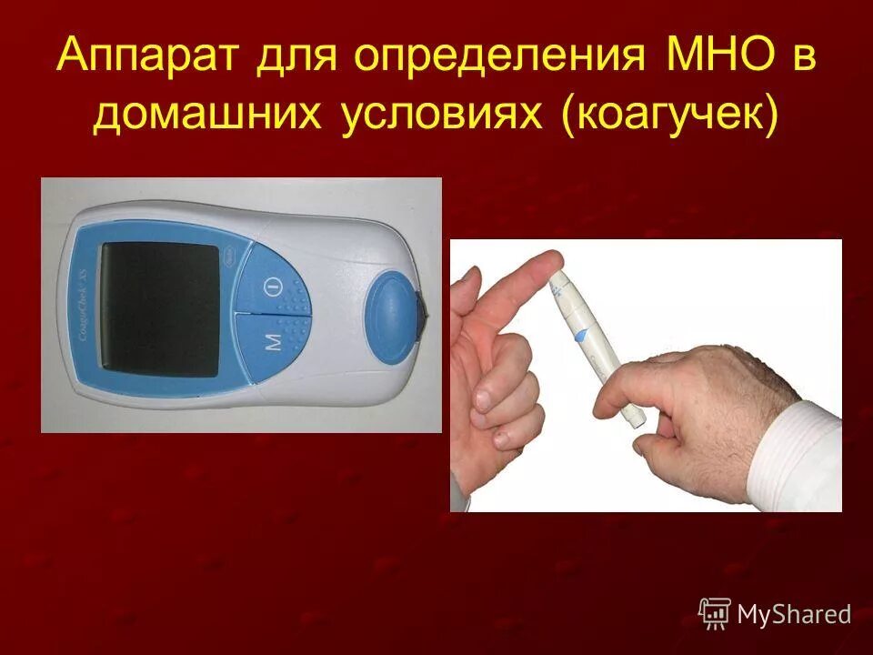 Прибор для определения мно. Коагулометр coaguchek xs. Мно аппарат для измерения крови коагучек. Коагулометр coaguchek® inrange. Экспресс - коагулометр кулабс электрометр ("qlabs electrometer").