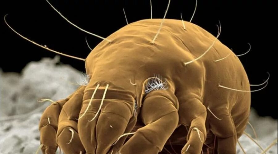 Бактерии клещей. Пылевые клещи микроскопические. Пылевой клещ под микроскопом.