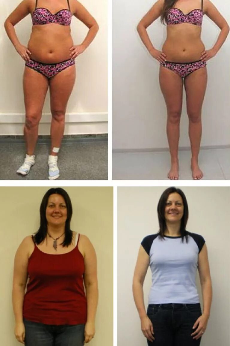 Помогает похудения реальные отзывы. Похудение до и после. Похудение до и после фото. Скакалка для похудения до и после. Похудела до и после.