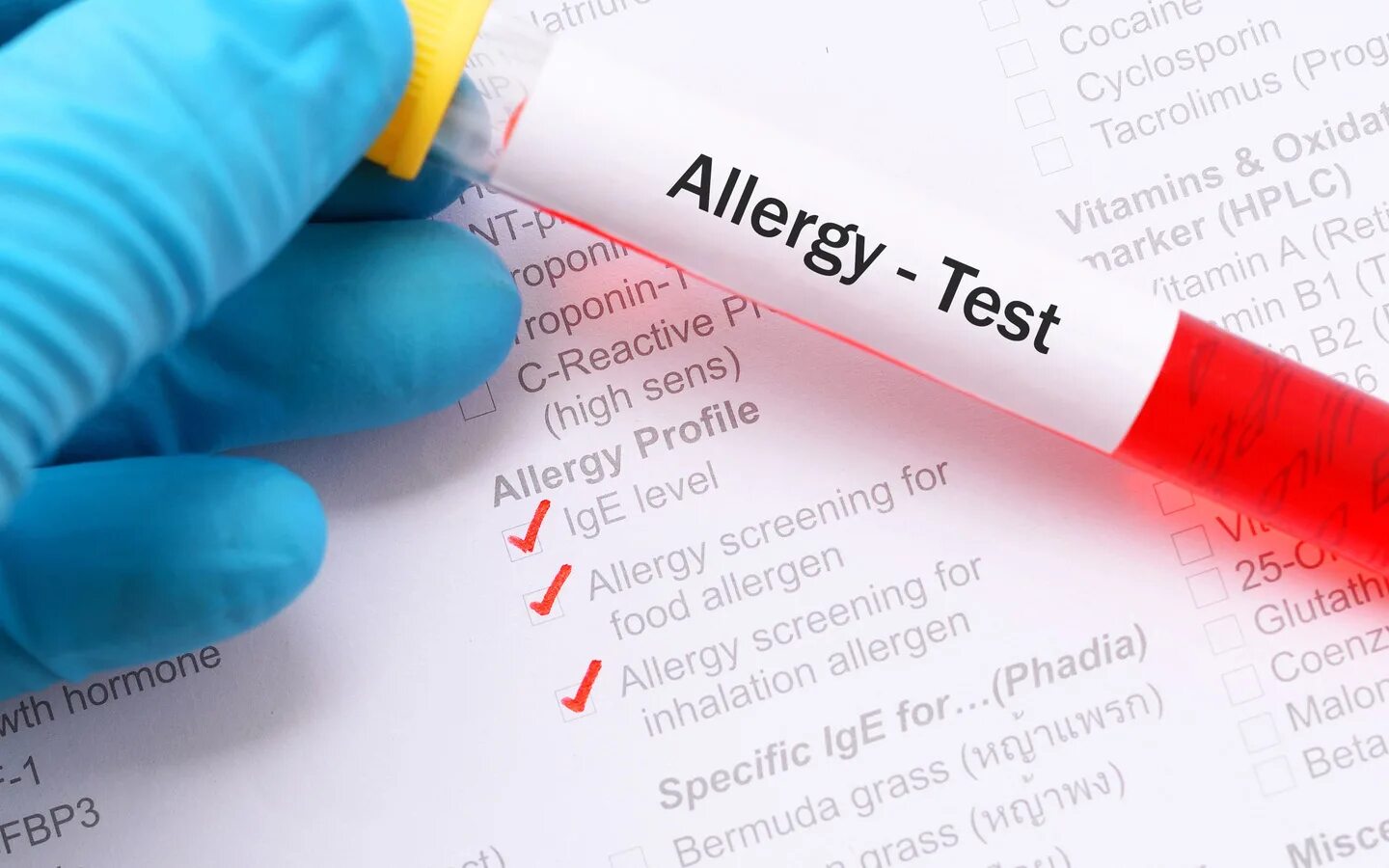 Выявление аллергена. Тест на выявление аллергии. Тест крови на аллергены. Исследований для выявления аллергена.