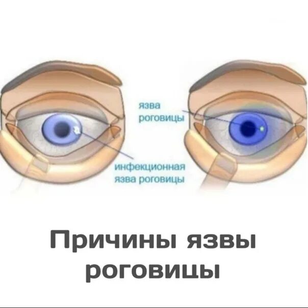 How to Fix Puffy Eyes After Crying Eye close up, Eyes artwork, Eye art