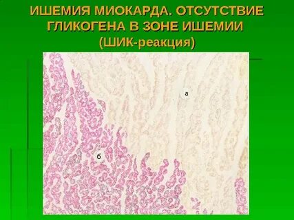 Шик реакция