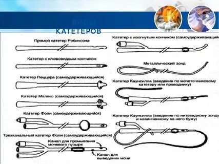 Катетеризация металлическим катетером