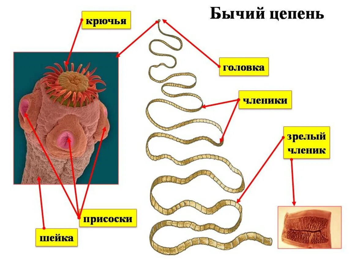 Цепень тип червей. Taeniarhynchus saginatus бычий цепень. Паразитические ленточные черви строение. Строение ленточных червей паразитов. Паразитические черви гельминты строение.