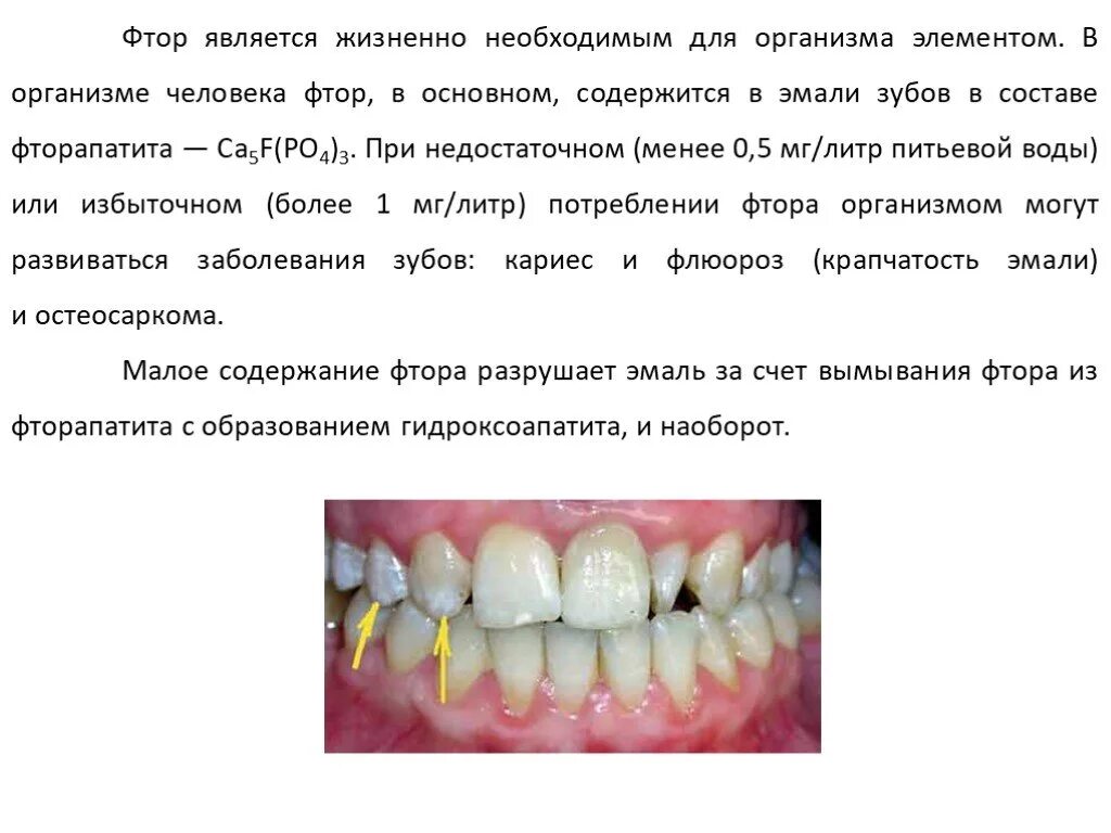 Недостаток фтора в организме развивается гигтест ответ. Недостаток фтора в организме зубы. Избыток фтора в организме зубы. Дефицит фтора в организме.