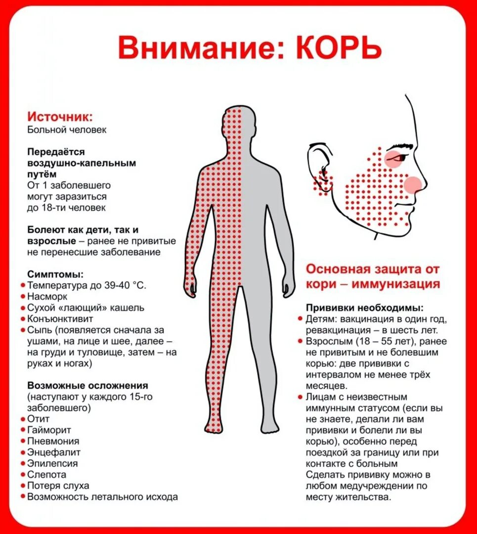 Корь симптомы профилактика. Инфекционное заболевание корь.