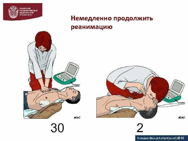 Неэффективные реанимационные мероприятия продолжаются. Буклет сердечно легочная реанимация. Сердечно легочная реанимация 30. Телементор сердечно легочная реанимация.