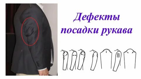 Дефект рук