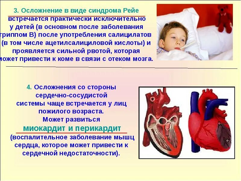 Осложнения на сердце после гриппа. Осложнения со стороны сердечно-сосудистой системы. Осложнения ССС заболеваний. Заболевания сердечно-сосудистой системы у детей.