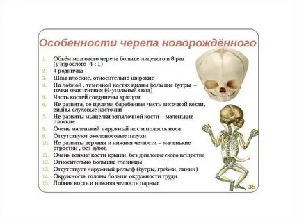 Особенности кости