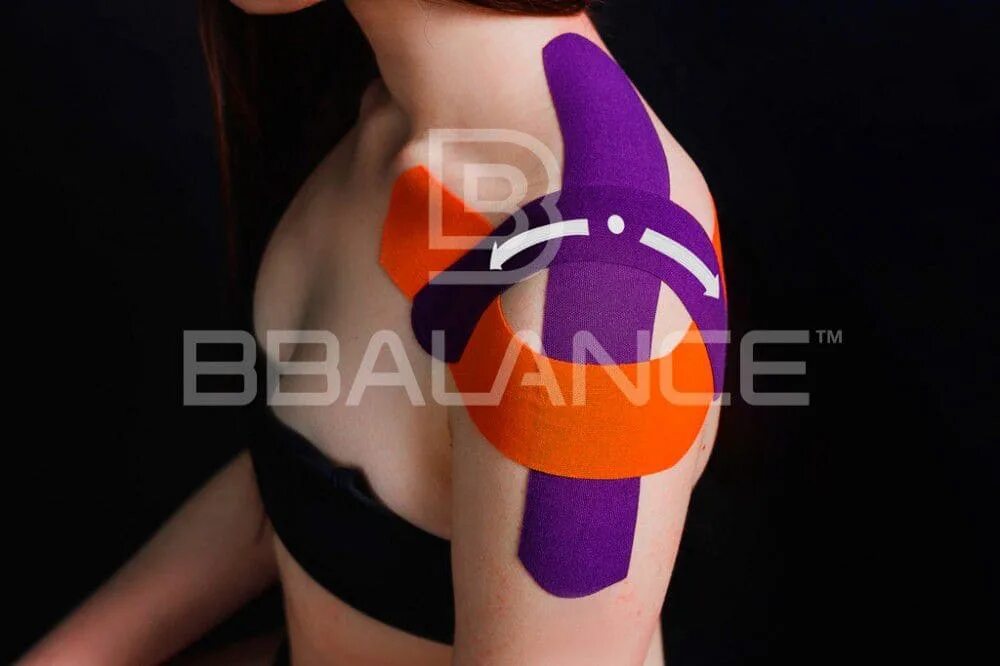 схема тейпирования плечевого сустава при вывихе. тейпирование плечевого сустава схема. растяжение плеча тейпирование. кинезио тейп на плечевой сустав. тейпирование коленного сустава.