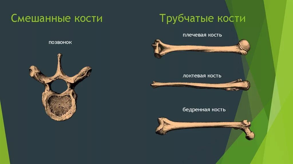 5 групп костей. Смешанные кости строение. Трубчатые кости человека. Полые трубчатые кости. Смешанная кость.