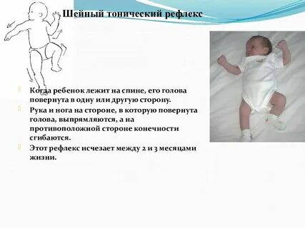 Новорожденный крутит головой из стороны в сторону