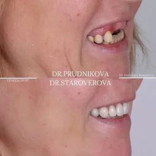 Венеция дент