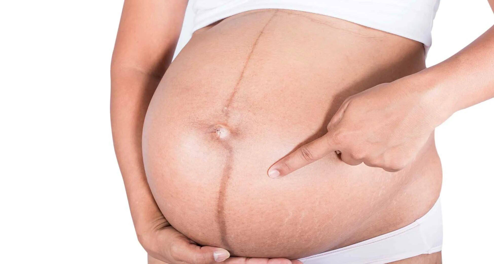 Во время беременности появляется. Линия на животе при беременности. Полоса на животе у беременных. Полоска на животе при беременности. Пигментная полоса на животе.
