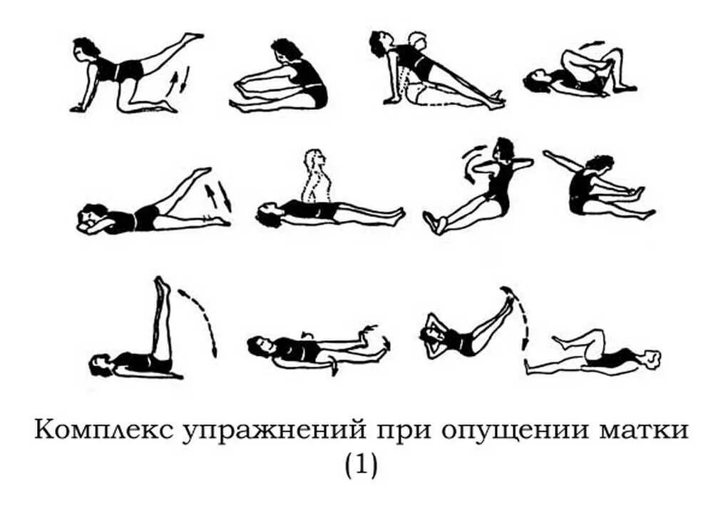 Упражнения гегеля. Опущение стенок матки упражнения. Гимнастика кегеля для женщин при опущении матки. Опущение матки лечебная гимнастика. Упражнение кегеля для женщин для укрепления мышц матки при опущении.