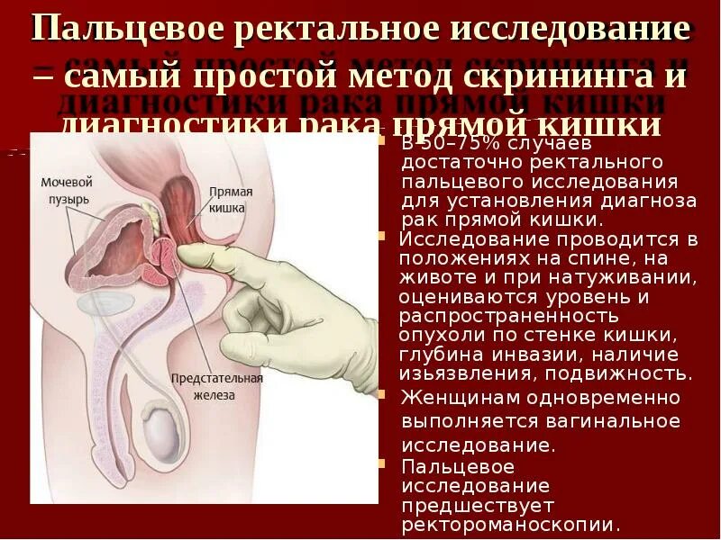 Ректальный метод. Пальцевое исследование прямой Кишк. Пальцевое исследование предстательной железы. Пальцевое ректальное исследование прямой кишки. Методы обследования пальцевое исследование прямой кишки.