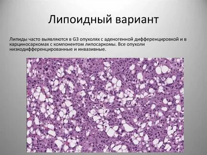 Липоидные тельца