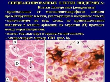 Клетки лангерганса