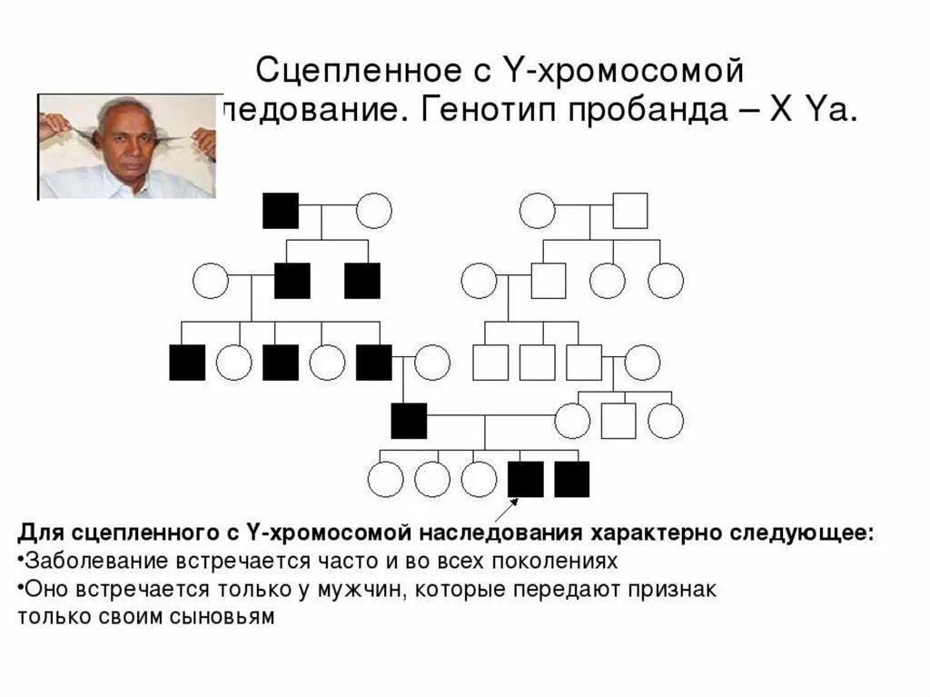 Заболевания сцепленные с y хромосомой. У сцепленный Тип наследования. Сцепленный с y-хромосомой. Сцепленное с y-хромосомой наследования. Родословная генетика.