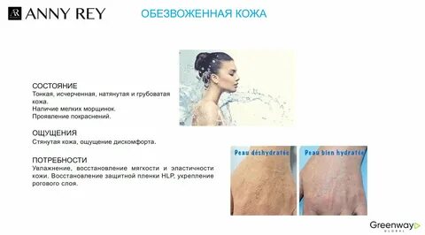 Ани рей