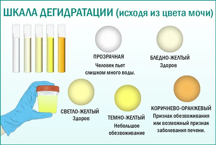 Что может быть из. Нормальный цвет мочи. Цвет мочи норма. Моча нормального цвета. Моча насыщенного желтого цвета.