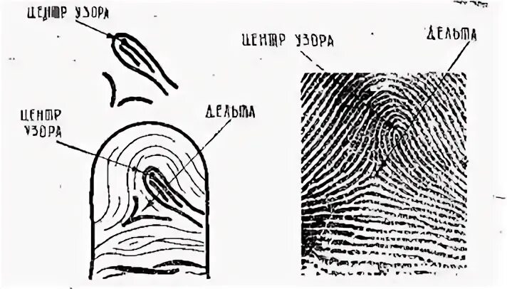 Дельта папиллярного узора