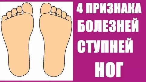 Заболели стопы ног