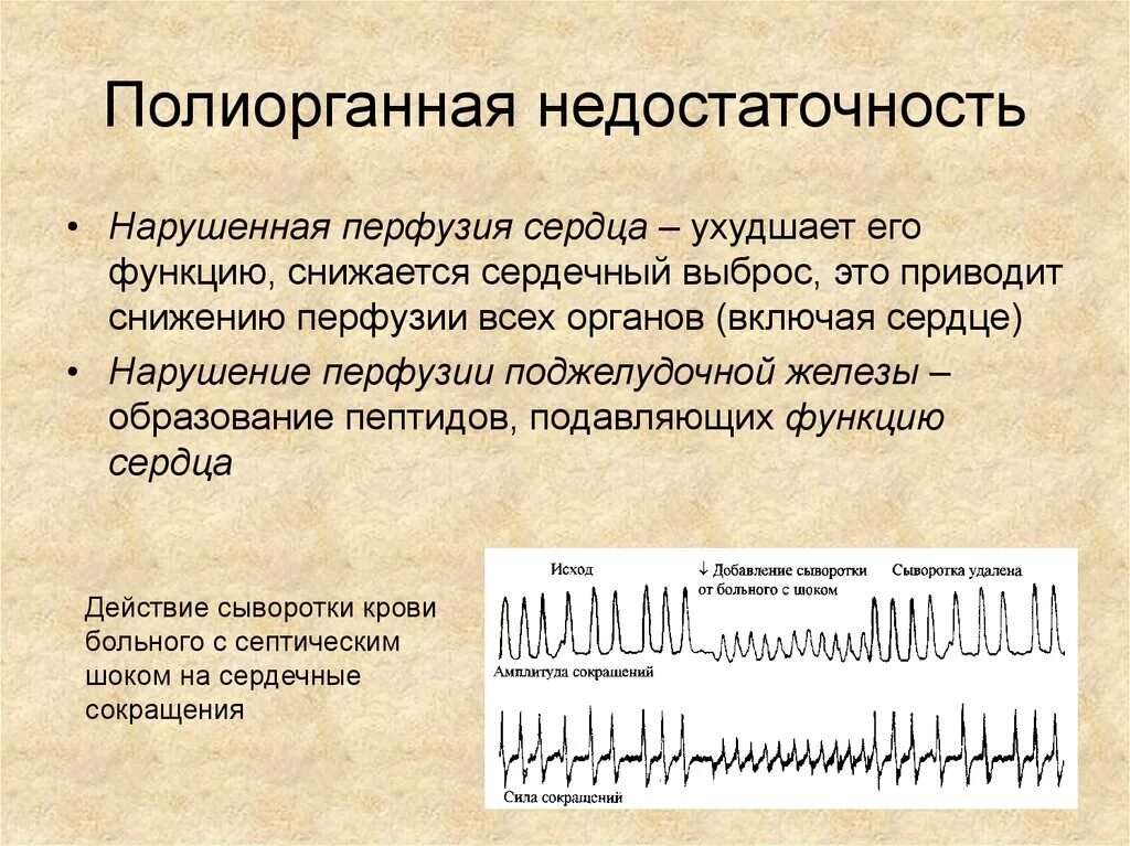 Полиорганная недостаточность что это такое. Полиорганная недостаточность. Подгортанная недостаточность. Перерганная недостаточность. Полиорганная недостаточность мкб 10.
