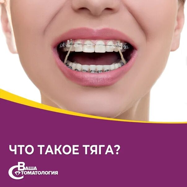 PRO ORTODONT, +48 791 876 888, Filtrowa 59/2, 02-056 Warsaw, Poland